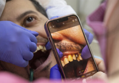 De ce să alegi tratamente dentare în România dacă locuiești în străinătate